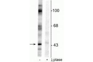 Western blot of rat testes lysate showing specific immunolabeling of the ~46 kDa EphrinB phosphorylated at Tyr317 in the first lane (-). (EPH Receptor B2 Antikörper  (pTyr317))