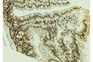 ABIN6269061 at 1/100 staining Mouse colon tissue by IHC-P. (JAK2 Antikörper  (N-Term))