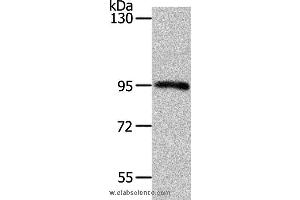 Western blot analysis of Mouse kidney tissue, using MYSM1 Polyclonal Antibody at dilution of 1:1100 (MYSM1 Antikörper)