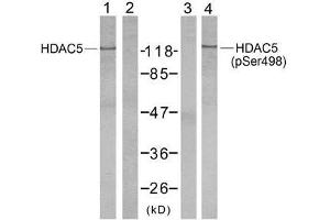 Western blot analysis of extract from NIH/3T3 cells using HDAC5 (Ab-498) antibody (E021142, Lane 1 and 2) and HDAC5 (phospho-Ser498) antibody (E011193, Lane 3 and 4). (HDAC5 Antikörper)