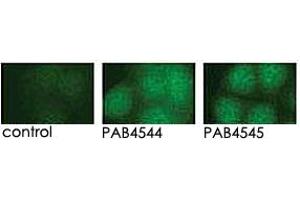 Indirect immunofluorescence analysis of GFP-PRKD3 fusion protein expression in Panc-1 cells by using PRKD3 polyclonal antibody  and PRKD3 polyclonal antibody  . (PRKD3 Antikörper  (Internal Region))