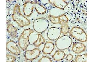 Immunohistochemistry of paraffin-embedded human kidney tissue using ABIN7146236 at dilution of 1:100 (CDH6 Antikörper  (AA 1-250))