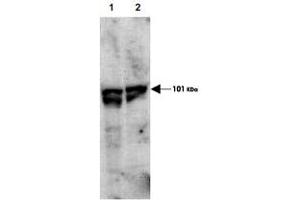 Western blot using ECT2 (phospho T790) polyclonal antibody  showsdetection of endogenous phospho-ECT2 (arrowhead) present in cell lysates from interphase (Lane 1) and mitotic (Lane 2) HeLa cells. (ECT2 Antikörper  (pThr790))