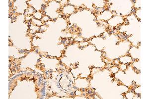 Immunohistochemistry (IHC) image for anti-Tumor Protein P73 (TP73) (pTyr99) antibody (ABIN6256817)
