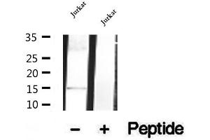 Western blot analysis of extracts of Jurkat cells, using SH2D1B antibody. (SH2D1B Antikörper  (Internal Region))