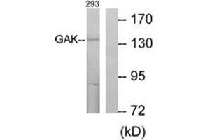 Western blot analysis of extracts from 293 cells, using GAK Antibody. (GAK Antikörper  (AA 101-150))