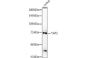 Western Blotting (WB) image for anti-Transporter 2, ATP-Binding Cassette, Sub-Family B (MDR/TAP) (TAP2) (AA 430-680) antibody (ABIN3022237)