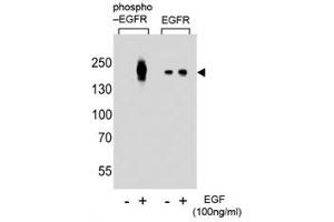 Western blot analysis of lysate from A431 cells (left to right), untreated or treated with EGF at 100ng/ml, using phospho-EGFR antibody (pY1016) or nonphos Ab at 1:8000 dilution.