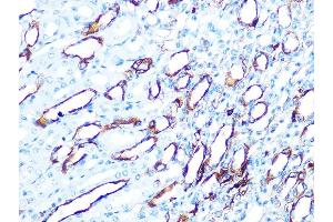 Immunohistochemistry (IHC) image for anti-Keratin 7 (KRT7) antibody (ABIN7268105)