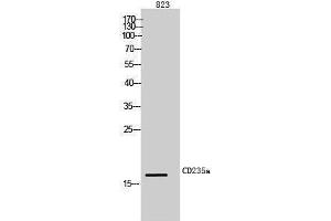 Western Blotting (WB) image for anti-Glycophorin A (GYPA) (Internal Region) antibody (ABIN6283927)