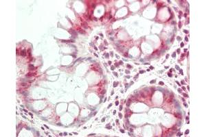 Immunohistochemistry (Paraffin-embedded Sections) (IHC (p)) image for anti-Vesicle Transport through Interaction with T-SNAREs Homolog 1B (VTI1B) (AA 146-195) antibody (ABIN6756676)