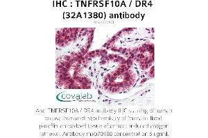 Image no. 1 for anti-Tumor Necrosis Factor Receptor Superfamily, Member 10a (TNFRSF10A) antibody (ABIN5693732) (TNFRSF10A Antikörper)