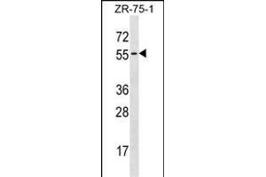 TCN1 Antibody (C-term) (ABIN1537288 and ABIN2838197) western blot analysis in ZR-75-1 cell line lysates (35 μg/lane). (TCN1 Antikörper  (C-Term))