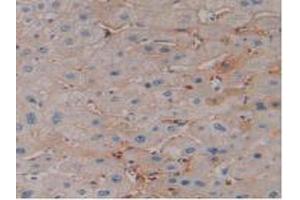 DAB staining on IHC-P; Samples: Human Liver Tissue (EPO Antikörper  (AA 28-193))