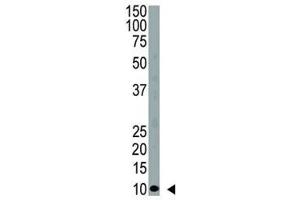 Western Blotting (WB) image for anti-Ubiquitin (Ub) (AA 1-32) antibody (ABIN3029419)