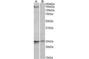 AP22405PU-N RBM20 antibody staining of Mouse Heart lysate at 1 µg/ml (35µg protein in RIPA buffer) with (B) and without (A) blocking with the immunising peptide. (RBM20 Antikörper  (AA 717-727))