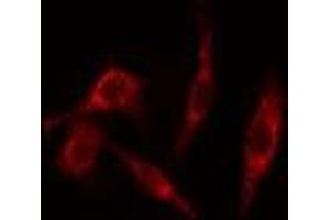 ABIN6277658 staining HeLa cells by IF/ICC. (TK1 Antikörper  (N-Term))