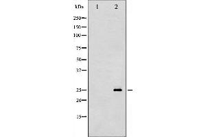 Western blot analysis of p27 Kip1 phosphorylation expression in A2780 whole cell lysates,The lane on the left is treated with the antigen-specific peptide.