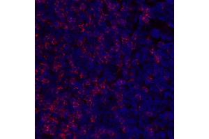 Immunofluorescence (IF) image for anti-CD8a Molecule (CD8A) (C-Term), (Cytoplasmic Domain) antibody (ABIN7449043)