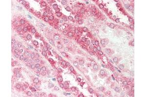 Immunohistochemistry (Paraffin-embedded Sections) (IHC (p)) image for anti-Guanine Nucleotide Binding Protein (G Protein), beta Polypeptide 1 (GNB1) (N-Term) antibody (ABIN6756650)