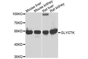 Western blot analysis of extracts of various cell lines, using GLYCTK antibody. (GLYCTK Antikörper  (AA 284-523))