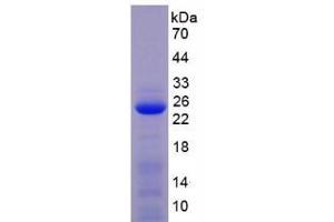 SDS-PAGE analysis of Mouse MMP1 Protein. (MMP1 Protein)