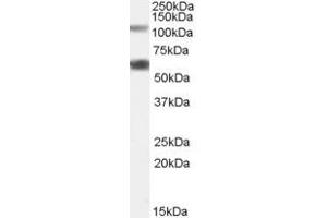 Western Blotting (WB) image for anti-Chromosome 19 Open Reading Frame 66 (C19ORF66) (N-Term) antibody (ABIN2791121) (C19ORF66 Antikörper  (N-Term))
