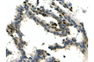 IHC analysis of ITCH/AIP4 using anti-ITCH/AIP4 antibody (ABIN7600264). (ITCH Antikörper  (AA 17-358))