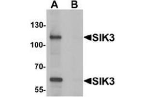 Western blot analysis of SIK3 in rat brain tissue lysate with SIK3 antibody at 1 ug/mL in (A) the absence and (B) the presence of blocking peptide.