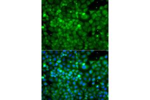 Immunofluorescence analysis of A549 cell using POC1A antibody. (POC1A Antikörper)