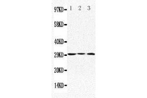 Anti-Apolipoprotein D antibody, Western blotting Lane 1: MCF-7 Cell Lysate Lane 2: HELA Cell Lysate Lane 3: SMMC Cell Lysate (Apolipoprotein D Antikörper  (C-Term))
