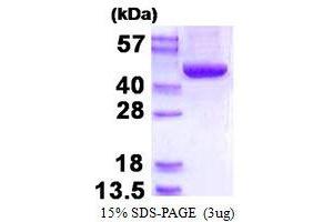 Acyl-CoA Dehydrogenase, Short/branched Chain (ACADSB) (AA 34-432) protein (His tag)