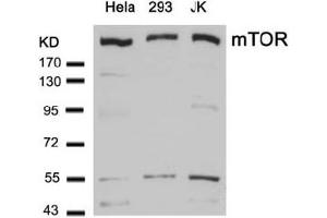 Image no. 1 for anti-Mechanistic Target of Rapamycin (serine/threonine Kinase) (mTOR) (Ser2448) antibody (ABIN319330) (MTOR Antikörper  (Ser2448))