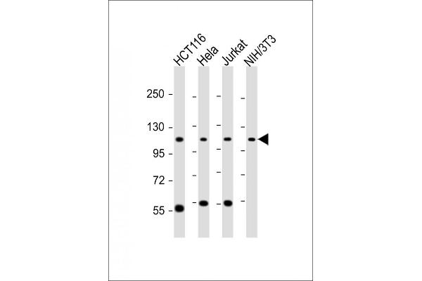 PRP6/ANT-1 Antikörper  (N-Term)