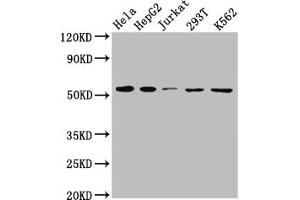 Western Blot Positive WB detected in: Hela whole cell lysate, HepG2 whole cell lysate, Jurkat whole cell lysate, 293T whole cell lysate, K562 whole cell lysate All lanes: MCT1 antibody at 1:1000 Secondary Goat polyclonal to rabbit IgG at 1/50000 dilution Predicted band size: 54, 47 kDa Observed band size: 54 kDa (Rekombinanter SLC16A1 Antikörper)