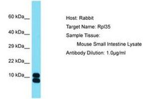 Image no. 1 for anti-Ribosomal Protein L35 (RPL35) (AA 61-110) antibody (ABIN6750520) (RPL35 Antikörper  (AA 61-110))