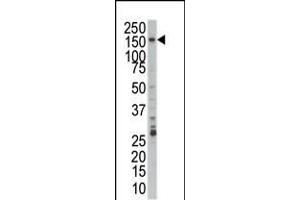 Western blot analysis of anti-PRP4 Pab in Jurkat cell lysate (PRPF4B Antikörper  (C-Term))