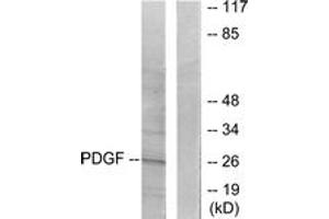 Western blot analysis of extracts from NIH-3T3 cells, using PDGFB Antibody. (PDGFB Antikörper  (AA 16-65))