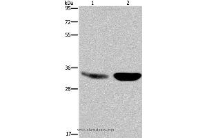 Western blot analysis of Human fetal brain and mouse brain tissue, using MAPRE3 Polyclonal Antibody at dilution of 1:500 (MAPRE3 Antikörper)