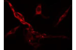 ABIN6274484 staining Hela cells by IF/ICC. (RPS6KC1 Antikörper  (Internal Region))