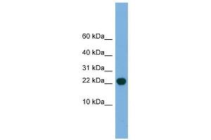 POP5 antibody used at 1 ug/ml to detect target protein. (POP5 Antikörper)