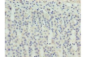 Immunohistochemistry of paraffin-embedded human adrenal gland tissue using ABIN7176155 at dilution of 1:100 (ZNF215 Antikörper  (AA 12-304))