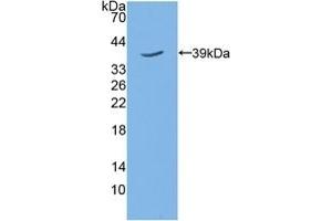 Detection of Recombinant TPBG, Mouse using Polyclonal Antibody to 5T4 (TPBG Antikörper  (AA 34-356))