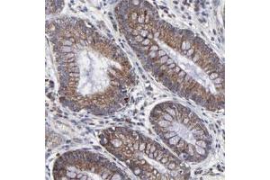 Immunohistochemical staining of human stomach with ZNF550 polyclonal antibody  shows cytoplasmic positivity in glandular cells. (ZNF550 Antikörper)