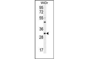 Western blot analysis of RILPL2 Antibody (Center) in WiDr cell line lysates (35ug/lane).