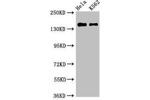 Western Blot Positive WB detected in: Hela whole cell lysate, K562 whole cell lysate All lanes: EEA1 antibody at 3 μg/mL Secondary Goat polyclonal to rabbit IgG at 1/50000 dilution Predicted band size: 163 kDa Observed band size: 163 kDa