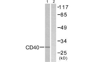 Western Blotting (WB) image for anti-CD40 (CD40) (C-Term) antibody (ABIN1848816) (CD40 Antikörper  (C-Term))