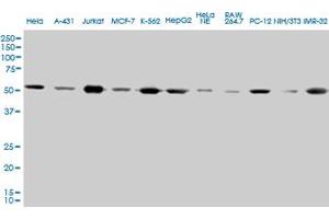 TUBA1 monoclonal antibody (M01), clone 2E11. (TUBA4A Antikörper  (AA 1-448))