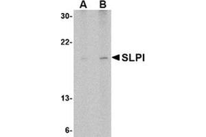 Image no. 1 for anti-Secretory Leukocyte Peptidase Inhibitor (SLPI) (Middle Region) antibody (ABIN318889) (SLPI Antikörper  (Middle Region))