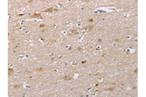 The image on the left is immunohistochemistry of paraffin-embedded Human brain tissue using ABIN7192262(SAMD9L Antibody) at dilution 1/30, on the right is treated with synthetic peptide. (SAMD9L Antikörper)